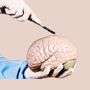 diseccion cerebral